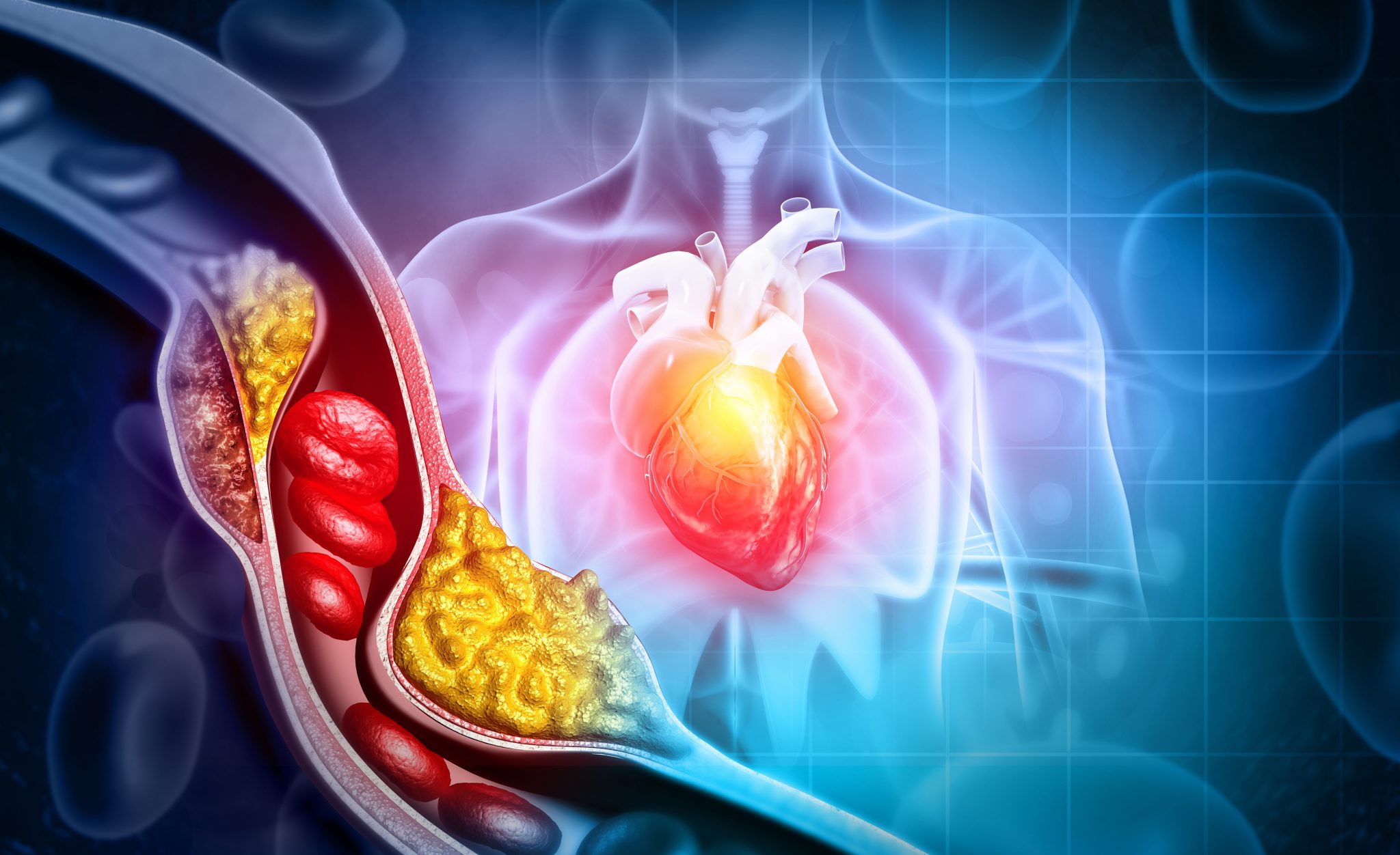 What Seniors Should Know About Cholesterol And Heart Disease Boom Health Blog
